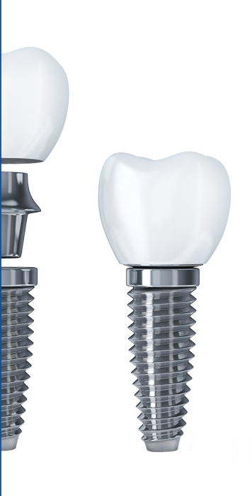 Implantologie Implantologie